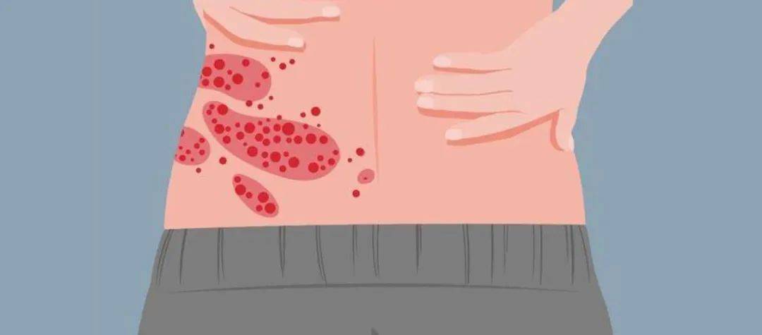 一旦感染终身携带!深圳疾控提醒:这4类人要注意