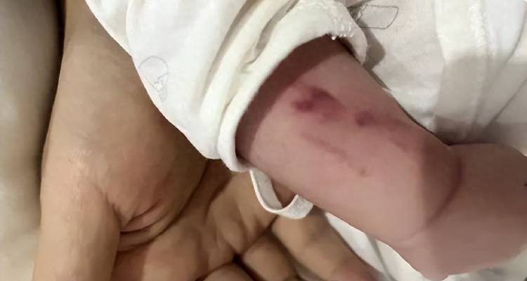 广西一男婴在月子中心被照料20天:身上2处骨折,育婴室监控无法查看