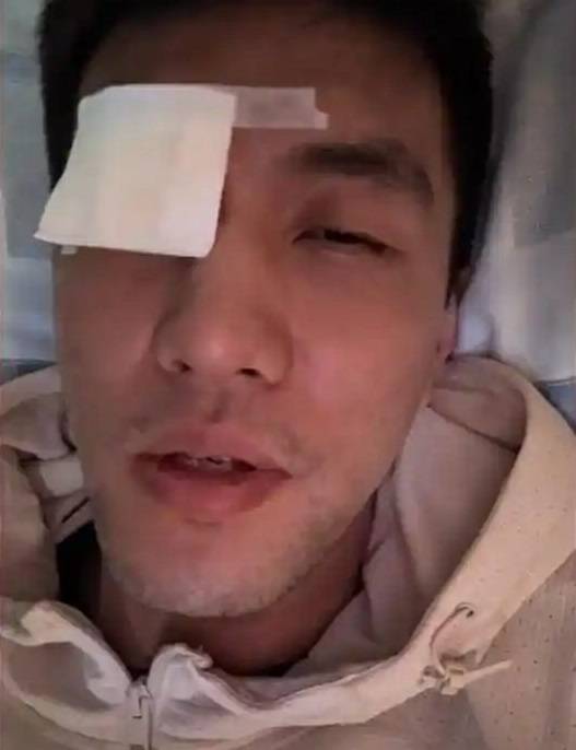 郭艾伦病床上接受采访 :医生说不会影响以后视力