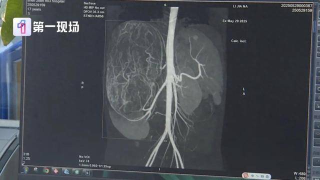 17岁女孩确诊癌症!买衣服时店员看出端倪……这个细节很重要!