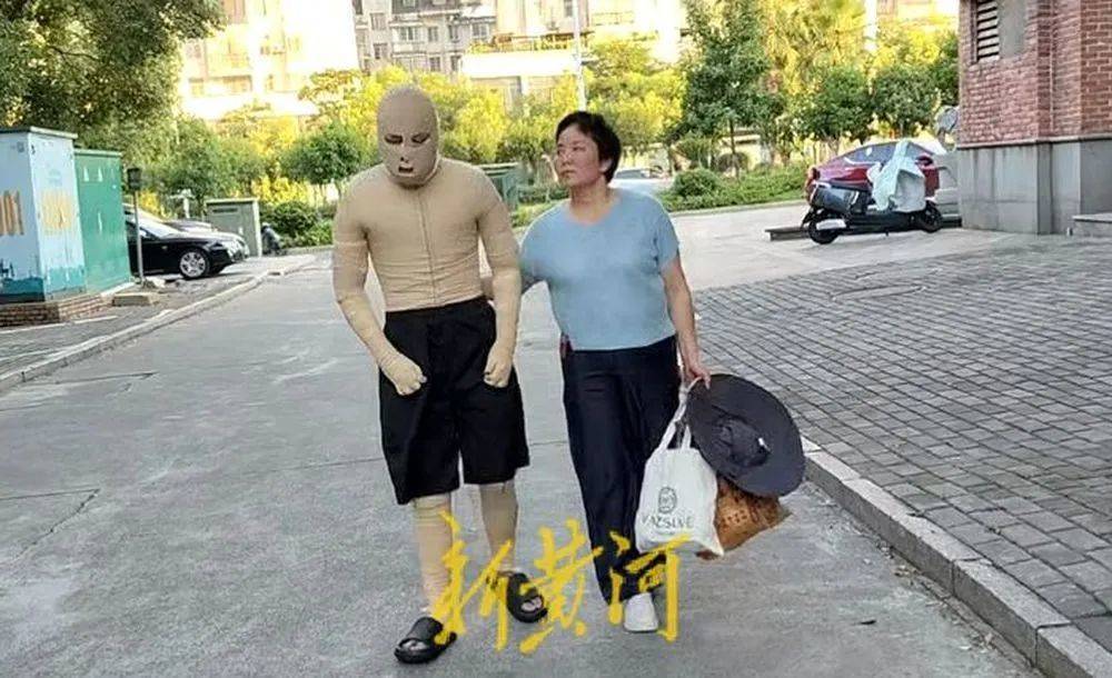 大学生因室友电动车燃爆,全身90%烧伤,治疗已花了290万元