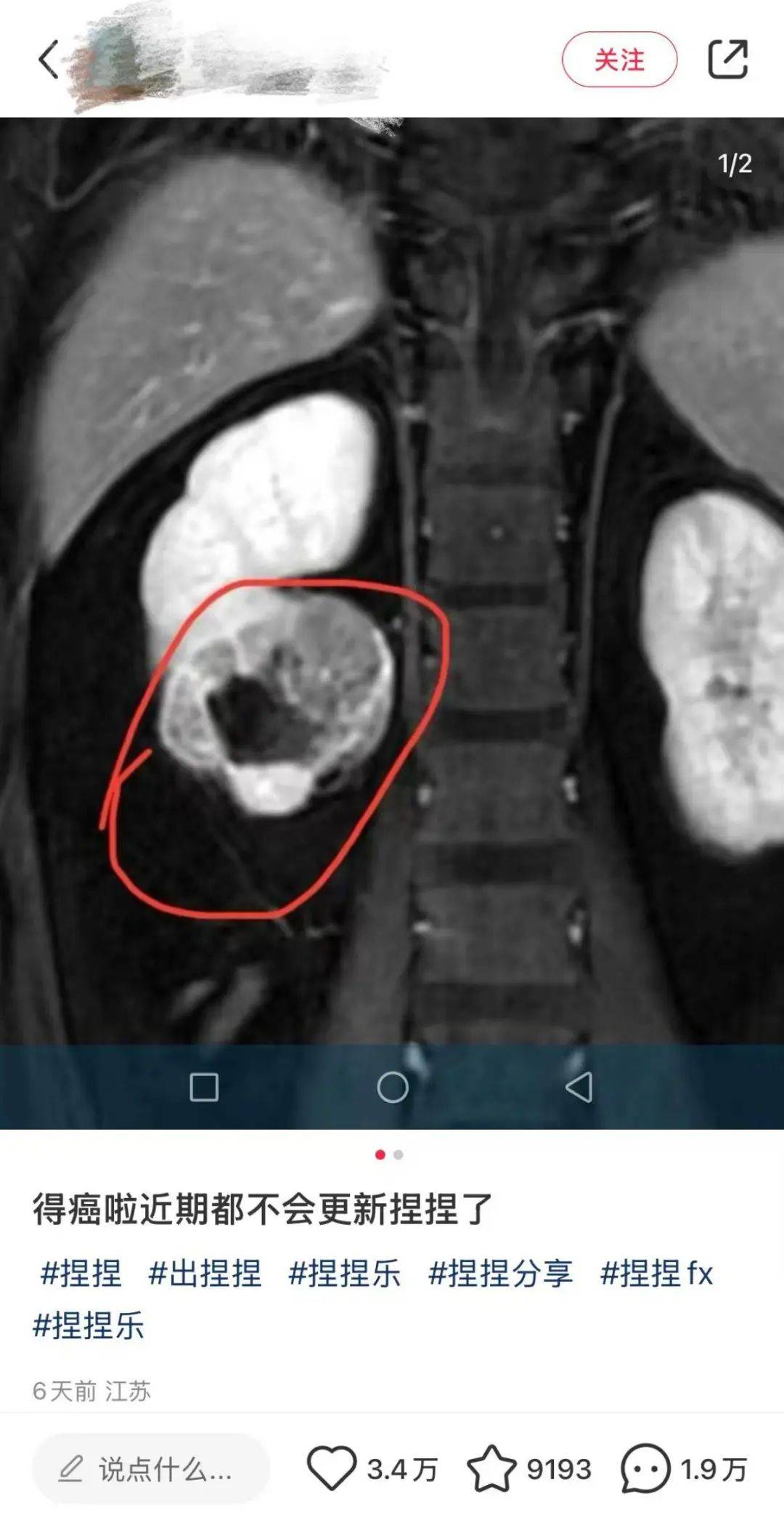 警惕!有毒物质100%超标,这款解压新宠你大概率也买过→