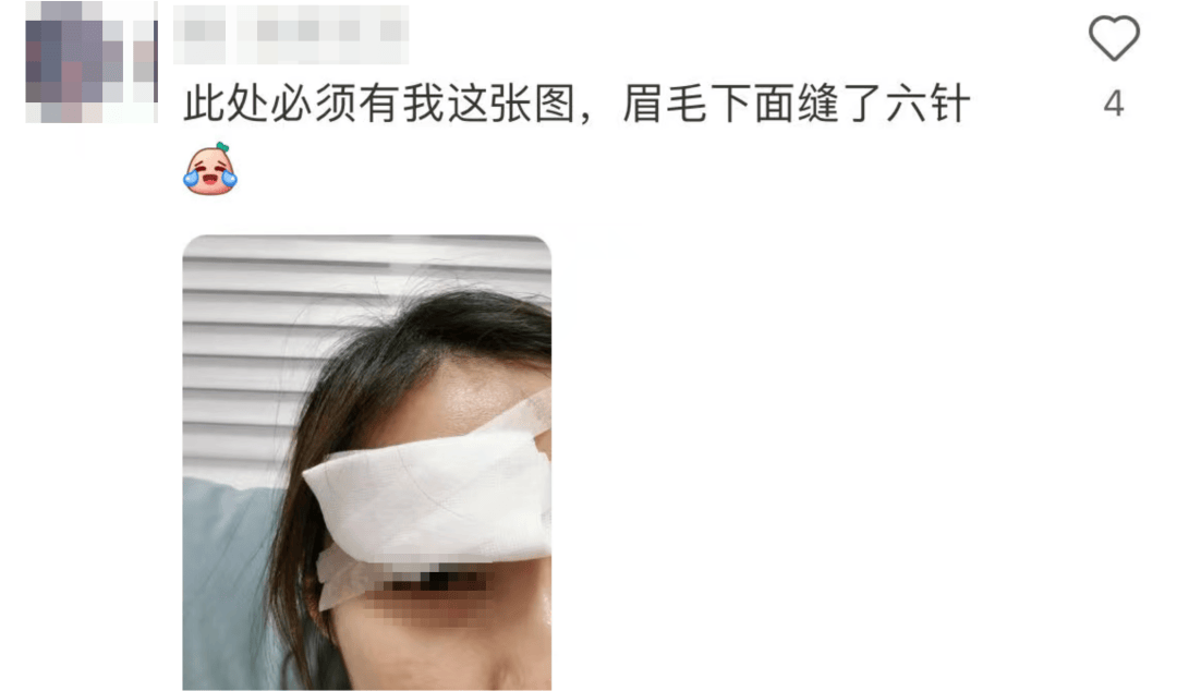 “杀伤力”惊人!击穿眉骨、扎穿手指……这项球速达300km/h的人气运动暗藏风险!