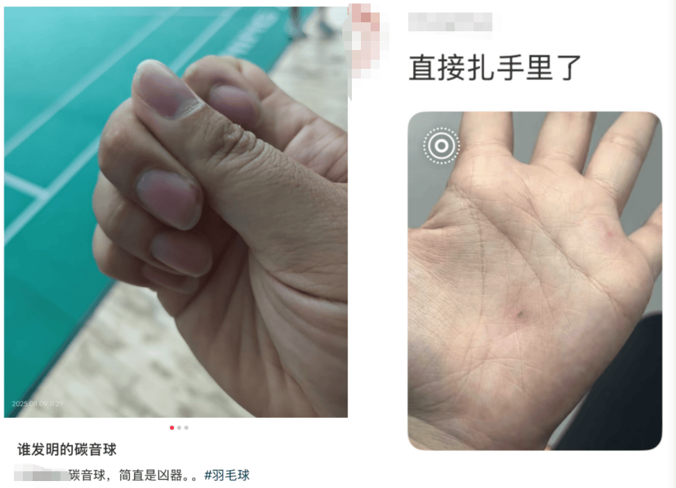 “杀伤力”惊人!击穿眉骨、扎穿手指……这项球速达300km/h的人气运动暗藏风险!